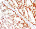 Detection of human MSH2 by immunohistochemistry.