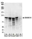 Detection of human and mouse EXOSC10 by western blot.