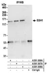 Detection of human SSH1 by western blot of immunoprecipitates.