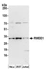 Detection of human RWDD1 by western blot.