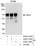 Detection of human AEG1 by western blot of immunoprecipitates.