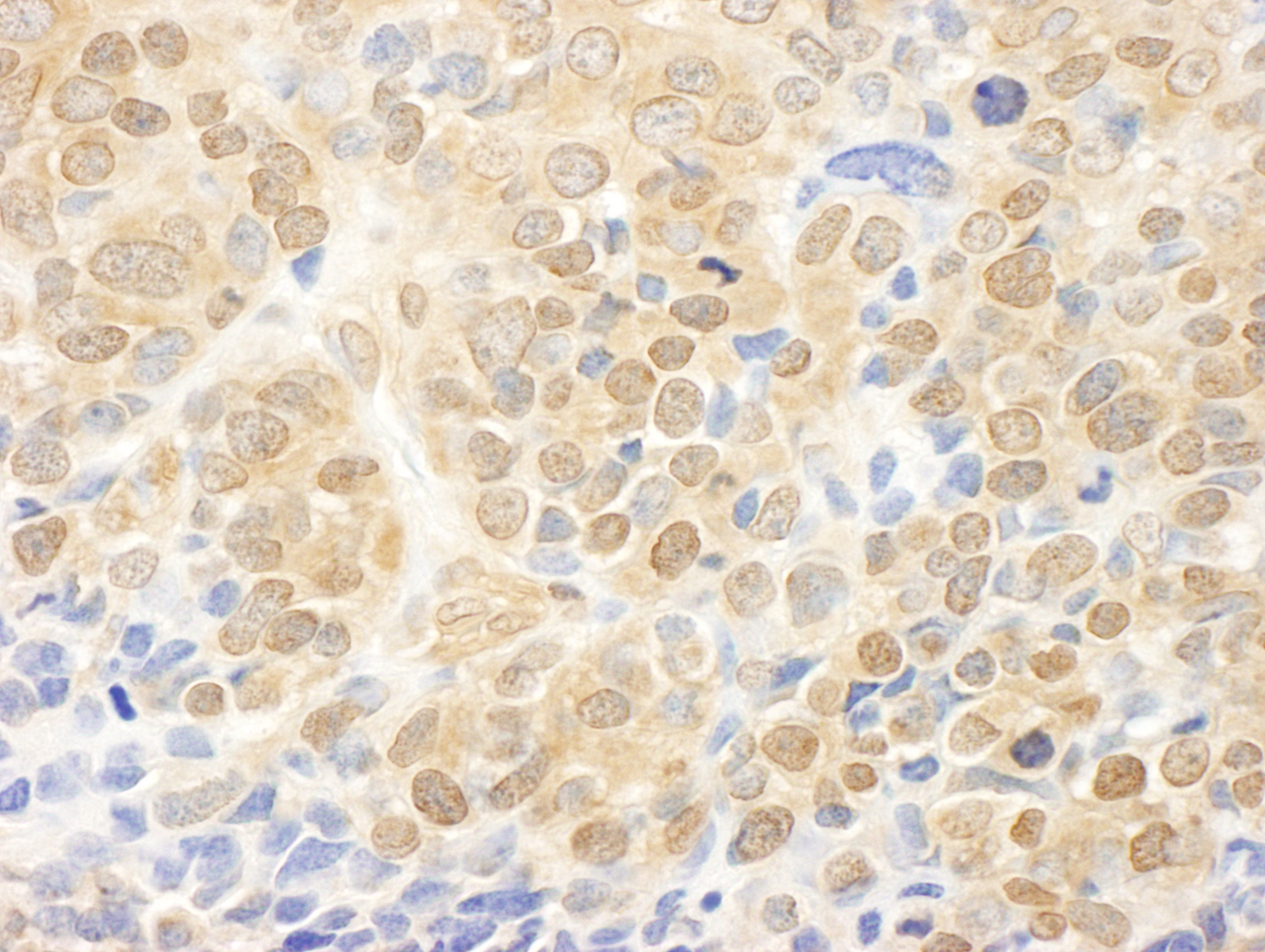 Rabbit anti-MEK1 IHC Antibody