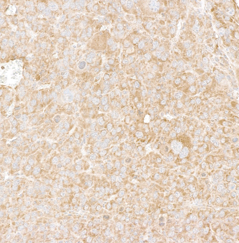 Detection of mouse DDX6 by immunohistochemistry.