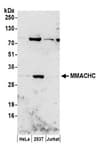 Detection of human MMACHC by western blot.