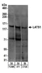 Detection of mouse LATS1 by western blot.