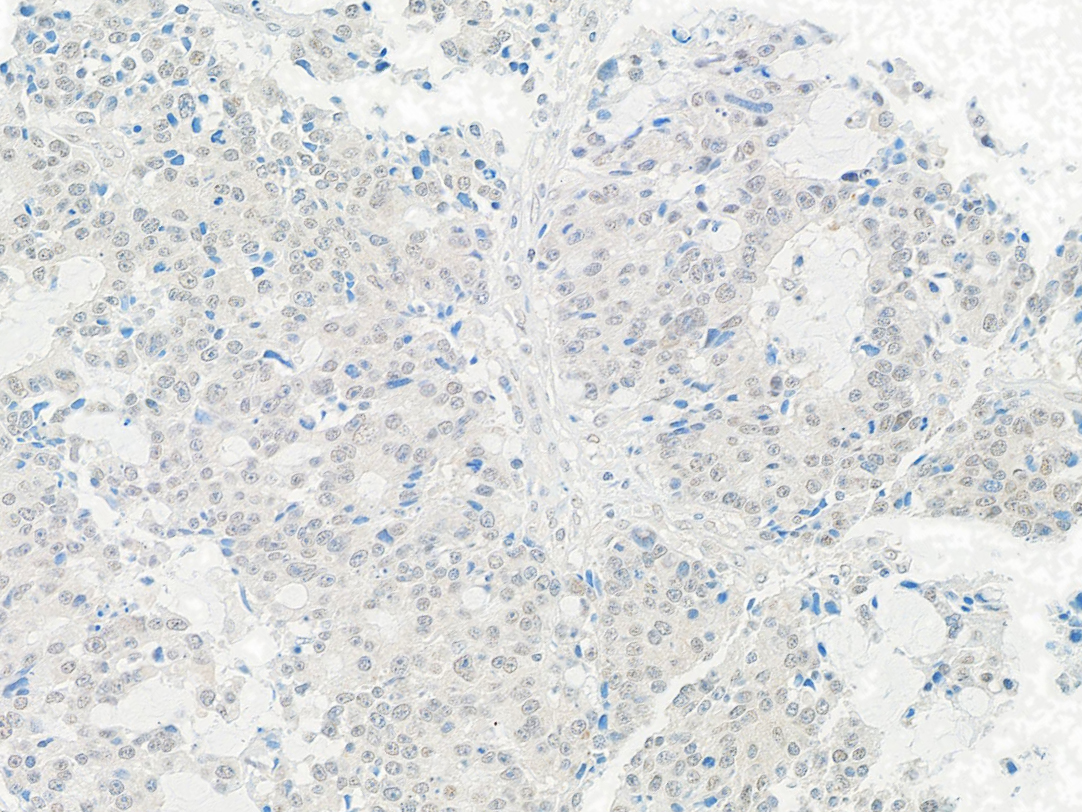 Detection of human Tip41 by immunohistochemistry.
