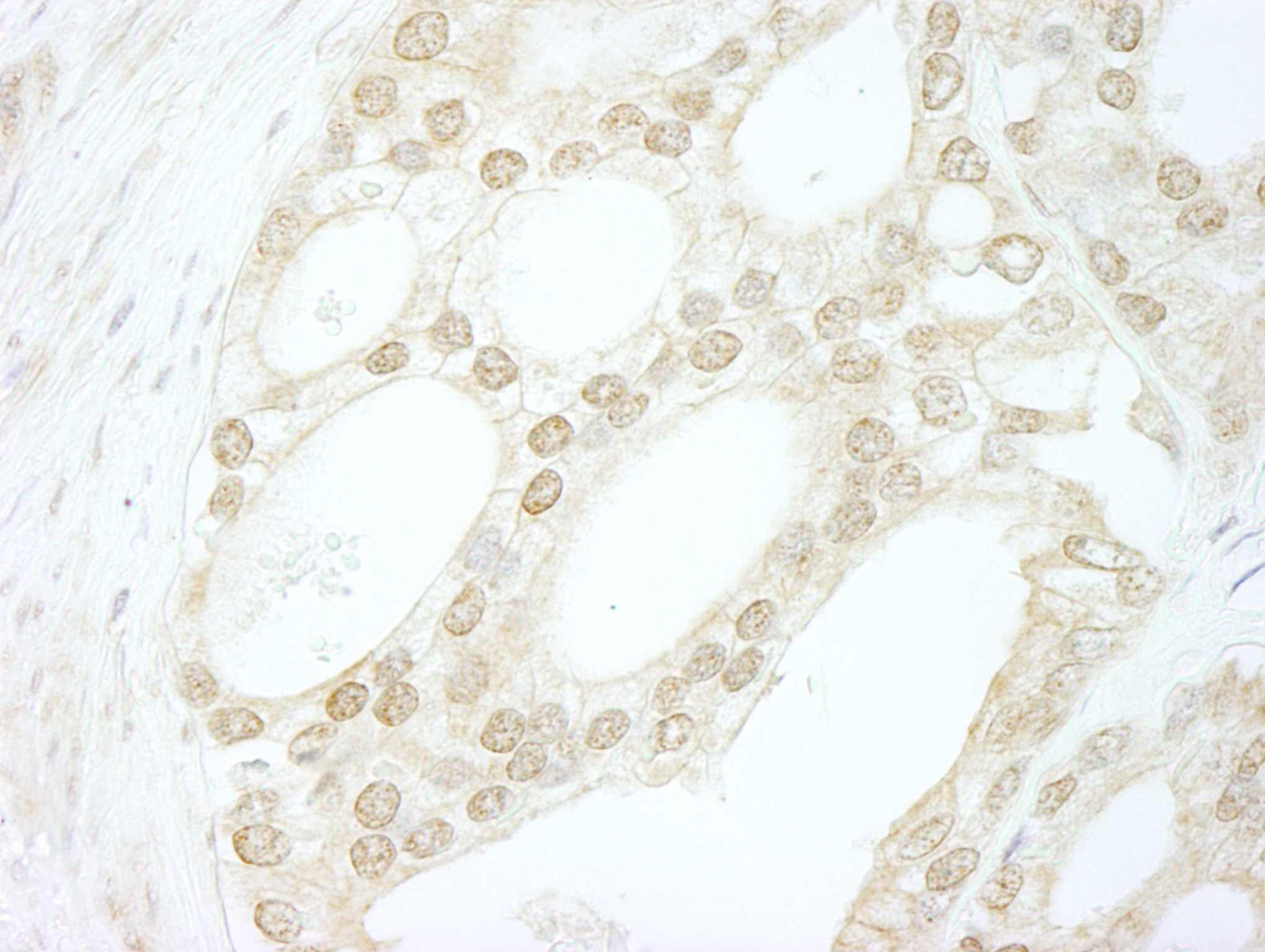 Rabbit anti-B-Myb IHC Antibody