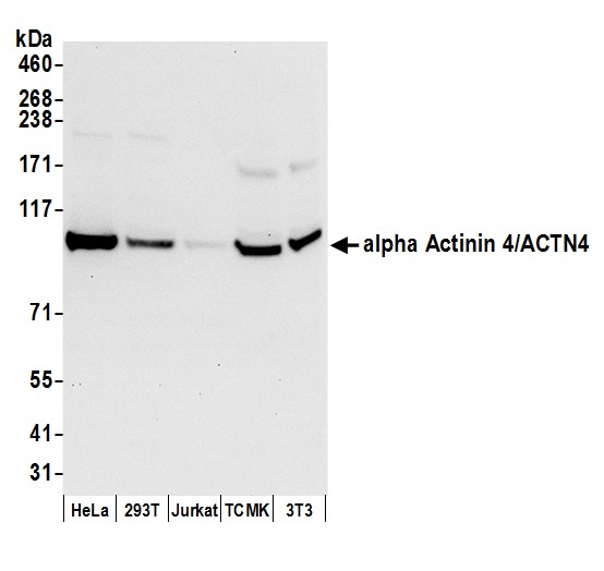 Detection of human and mouse alpha Actinin 4/ACTN4 by western blot.