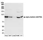 Detection of human and mouse alpha Actinin 4/ACTN4 by western blot.