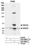 Detection of human ESCO2 by western blot of immunoprecipitates.