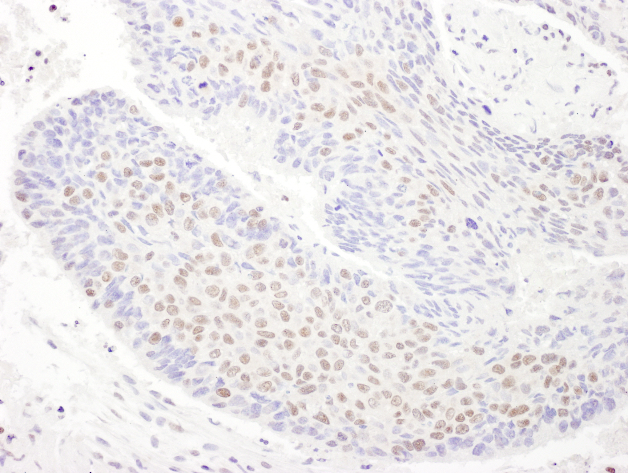 Detection of human TDP43 by immunohistochemistry.