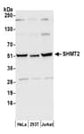 Detection of human SHMT2 by western blot.
