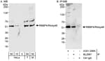 Detection of human and mouse RBBP4/RbAp48 by western blot (h&amp;m) and immunoprecipitation (h).