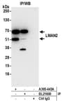 Detection of human LMAN2 by western blot of immunoprecipitates.