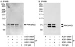 Detection of human PPP2R5D by western blot of immunoprecipitates.