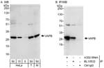 Detection of human and mouse VAPB by western blot (h&amp;m) and immunoprecipitation (h).