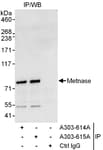 Detection of human Metnase by western blot of immunoprecipitates.