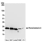 Detection of human and mouse Peroxiredoxin-3 by western blot.
