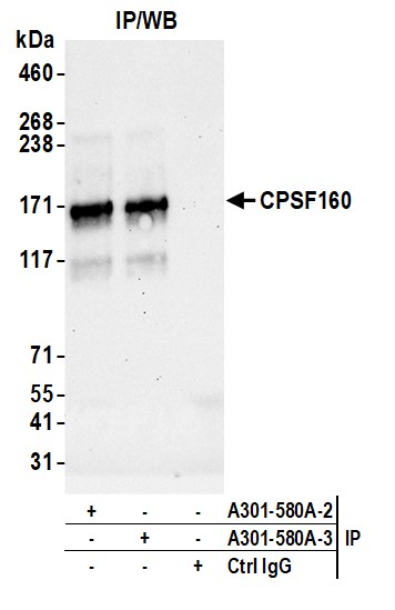 Detection of human CPSF160 by western blot of immunoprecipitates.