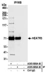 Detection of human HEATR3 by western blot of immunoprecipitates.