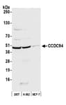 Detection of human CCDC94 by western blot.