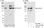 Detection of human CCDC18 by western blot and immunoprecipitation.