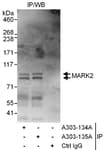 Detection of human MARK2 by western blot of immunoprecipitates.