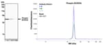 Detection of human pBCKDHA (S292) by Simple Western™.