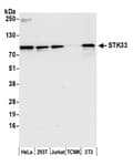 Detection of human and mouse STK33 by western blot.