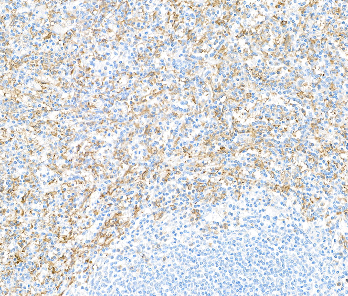 I-RabBits CD16枚セット Rabbit anti-CD16A Recombinant Monoclonal Antibody [BLR162J]