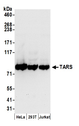 Detection of human TARS by western blot.