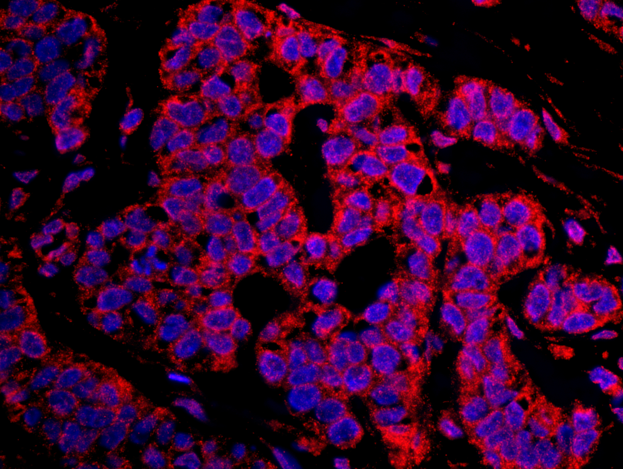 Rabbit anti-CASC3 IHC Antibody