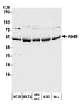 Detection of human Rad9 by western blot.