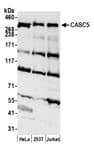 Detection of human CASC5 by western blot.