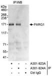 Detection of human PARG1 by western blot of immunoprecipitates.