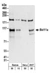Detection of human Bcl11a by western blot.