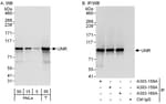 Detection of human UNR by western blot and immunoprecipitation.