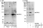 Detection of human and mouse ERK3 by western blot (h&amp;m) and immunoprecipitation (h).