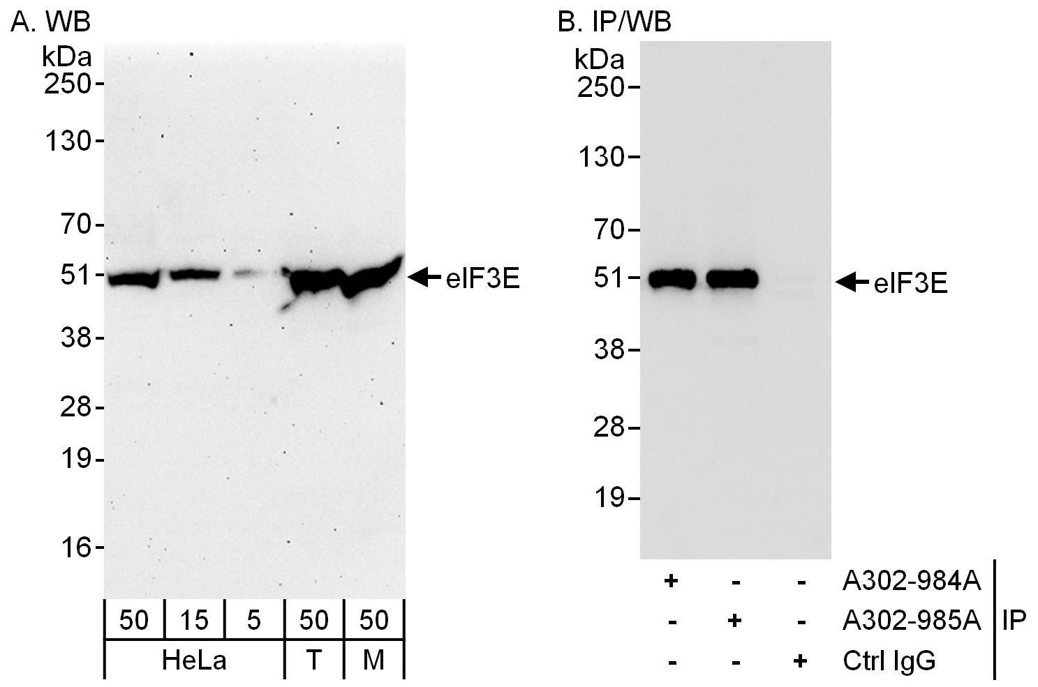 Detection of human and mouse eIF3E by western blot (h&amp;m) and immunoprecipitation (h).