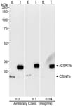 Detection of human CSN7b by western blot.