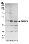 Detection of human RANBP9 by western blot.
