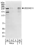 Detection of human ZCCHC11 by western blot.