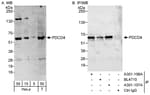 Detection of human PDCD4 by western blot and immunoprecipitation.