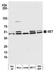 Detection of human SET by western blot.