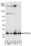 Detection of human RPS24 by western blot.