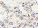Detection of human ZNF592 by immunohistochemistry.