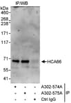 Detection of human HCA66 by western blot of immunoprecipitates.