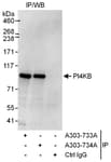 Detection of human PI4KB by western blot of immunoprecipitates.