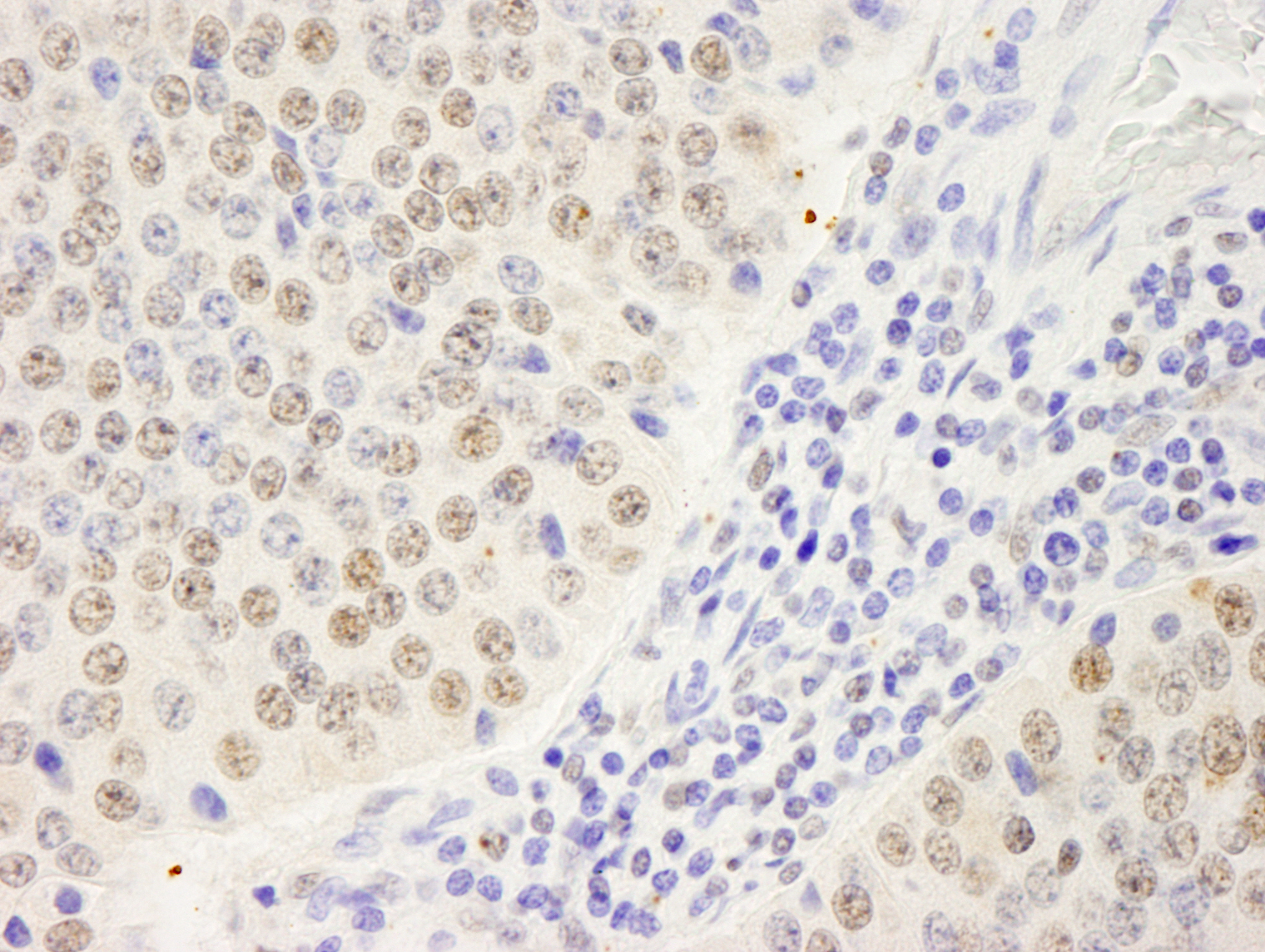 Rabbit anti-Symplekin IHC Antibody