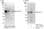 Detection of human HOXC10 by western blot and immunoprecipitation.